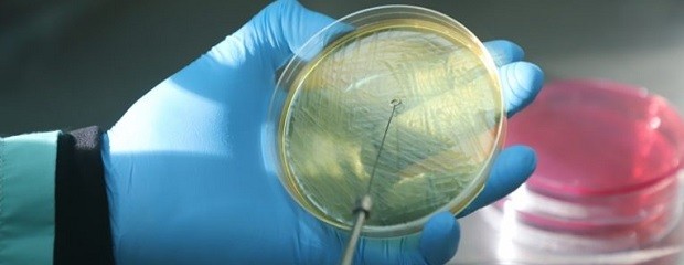 Desarrollan una vacuna contra la Escherichia coli en bovinos